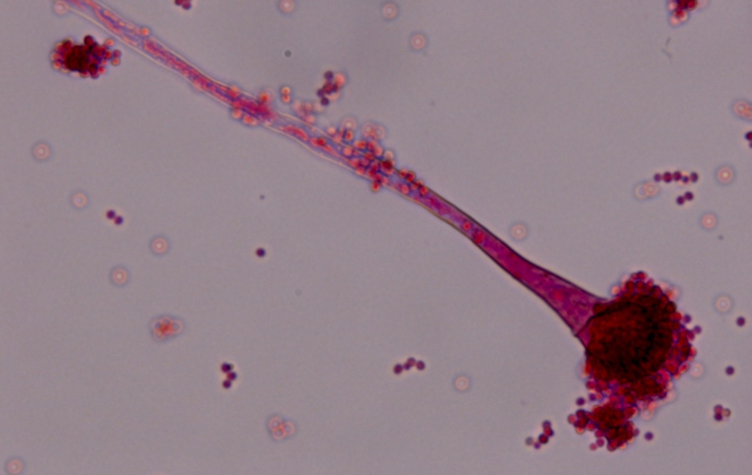 Imagen al microscopio de 'Aspergillus fumigatus', hongo causante de enfermedades respiratorias que afectan especialmente a personas inmunodeprimidas. 