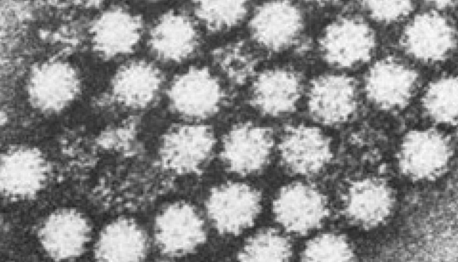 Micrografía electrónica de norovirus. 